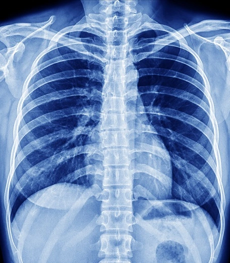 A medical lab from our Oxford medicine summer course xray